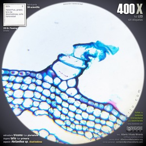 Tricoma pluricelular
